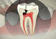 Endodontics