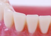 Periodontics