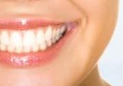 Teeth Whitening